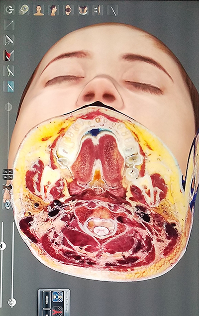 Cross section of head