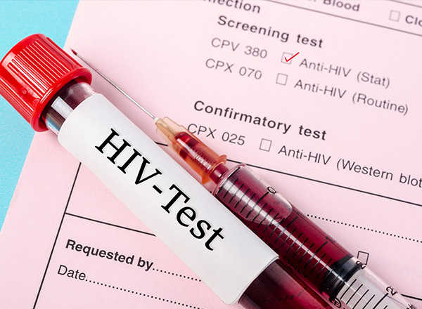 Sample blood collection tube with HIV test label on HIV infection screening test form.